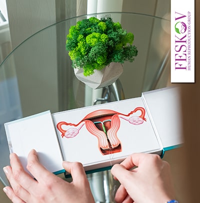 différence imsi icsi