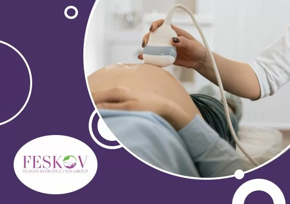 prix ​​de substitution des Pays-Bas